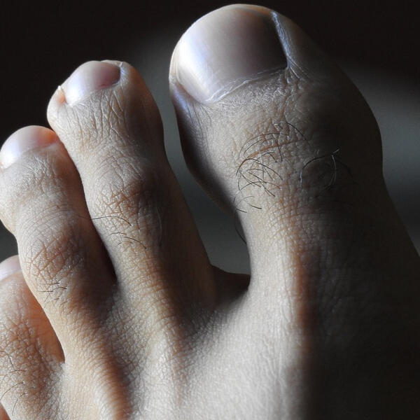 Harold's Toes